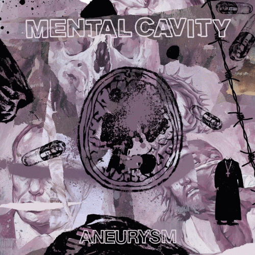 Mental Cavity : Aneurysm